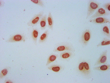 Western Blot, Positive WB detected in: Hela whole cell lysate, 293 whole cell lysate (treated by 30mM sodium crotonylate for 4h), All lanes: HIST1H2AG antibody at 0.3ug/ml, Secondary, Goat polyclonal to rabbit IgG at 1/50000 dilution, Predicted band size: 15 kDa, Observed band size: 15 kDa