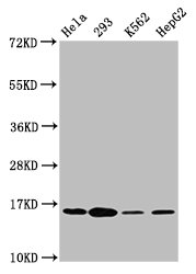 Immunofluorescence staining of Hela cells with CAC15280 at 1:2.5, counter-stained with DAPI. The cells were fixed in 4% formaldehyde, permeabilized using 0.2% Triton X-100 and blocked in 10% normal Goat Serum. The cells were then incubated with the antibody overnight at 4°C. The secondary antibody was Alexa Fluor 488-congugated AffiniPure Goat Anti-Rabbit IgG(H+L).
