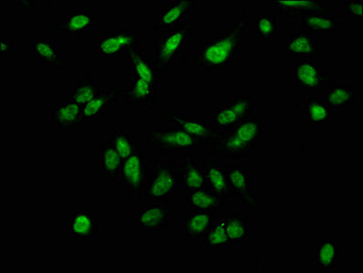 Chromatin Immunoprecipitation Hela (4*10 6 ) were treated with Micrococcal Nuclease, sonicated, and immunoprecipitated with 5ug anti-H2AFX (CAC15280) or a control normal rabbit IgG. The resulting ChIP DNA was quantified using real-time PCR with primers against the β-Globin promoter.