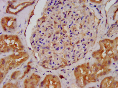 IHC image of CAC15295 diluted at 1:400 and staining in paraffin-embedded human liver tissue performed on a Leica BondTM system. After dewaxing and hydration, antigen retrieval was mediated by high pressure in a citrate buffer (pH 6.0). Section was blocked with 10% normal goat serum 30min at RT. Then primary antibody (1% BSA) was incubated at 4°C overnight. The primary is detected by a biotinylated secondary antibody and visualized using an HRP conjugated SP system.
