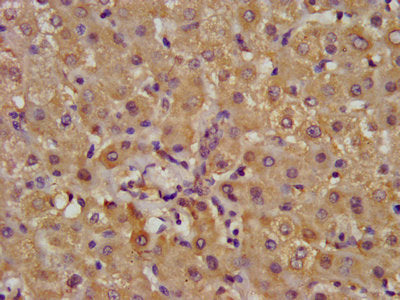 Immunofluorescence staining of Hela cells with CAC15295 at 1:133, counter-stained with DAPI. The cells were fixed in 4% formaldehyde, permeabilized using 0.2% Triton X-100 and blocked in 10% normal Goat Serum. The cells were then incubated with the antibody overnight at 4°C. The secondary antibody was Alexa Fluor 488-congugated AffiniPure Goat Anti-Rabbit IgG(H+L).