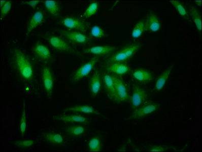 ALDH7A1 Polyclonal Antibody - image 5