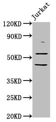 Immunofluorescence staining of SH-SY5Y cells with CAC15297 at 1:133, counter-stained with DAPI. The cells were fixed in 4% formaldehyde, permeabilized using 0.2% Triton X-100 and blocked in 10% normal Goat Serum. The cells were then incubated with the antibody overnight at 4°C. The secondary antibody was Alexa Fluor 488-congugated AffiniPure Goat Anti-Rabbit IgG(H+L).