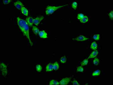 IHC image of CAC15297 diluted at 1:400 and staining in paraffin-embedded human kidney tissue performed on a Leica BondTM system. After dewaxing and hydration, antigen retrieval was mediated by high pressure in a citrate buffer (pH 6.0). Section was blocked with 10% normal goat serum 30min at RT. Then primary antibody (1% BSA) was incubated at 4°C overnight. The primary is detected by a biotinylated secondary antibody and visualized using an HRP conjugated SP system.