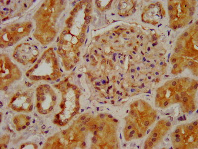 CHRNB2 Polyclonal Antibody - image 4