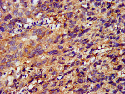 Immunofluorescence staining of HepG2 cells with CAC15308 at 1:133, counter-stained with DAPI. The cells were fixed in 4% formaldehyde, permeabilized using 0.2% Triton X-100 and blocked in 10% normal Goat Serum. The cells were then incubated with the antibody overnight at 4°C. The secondary antibody was Alexa Fluor 488-congugated AffiniPure Goat Anti-Rabbit IgG(H+L).