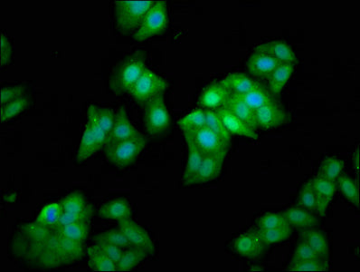 METAP1 Polyclonal Antibody - image 5