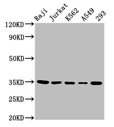 Immunofluorescence staining of HepG2 cells with CAC15315 at 1:100, counter-stained with DAPI. The cells were fixed in 4% formaldehyde, permeabilized using 0.2% Triton X-100 and blocked in 10% normal Goat Serum. The cells were then incubated with the antibody overnight at 4°C. The secondary antibody was Alexa Fluor 488-congugated AffiniPure Goat Anti-Rabbit IgG(H+L).