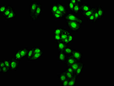 TAL1 Polyclonal Antibody - image 3