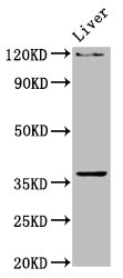 Immunofluorescence staining of MCF-7 cells with CAC15317 at 1:100, counter-stained with DAPI. The cells were fixed in 4% formaldehyde, permeabilized using 0.2% Triton X-100 and blocked in 10% normal Goat Serum. The cells were then incubated with the antibody overnight at 4°C. The secondary antibody was Alexa Fluor 488-congugated AffiniPure Goat Anti-Rabbit IgG(H+L).