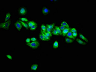 ARSH Polyclonal Antibody - image 3