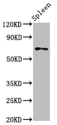 IHC image of CAC15325 diluted at 1:400 and staining in paraffin-embedded human lung cancer performed on a Leica BondTM system.