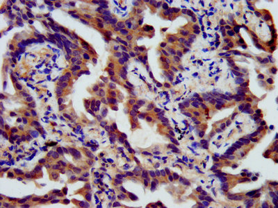 Immunofluorescence staining of Hela cells with CAC15325 at 1:133, counter-stained with DAPI. The cells were fixed in 4% formaldehyde, permeabilized using 0.2% Triton X-100 and blocked in 10% normal Goat Serum. The cells were then incubated with the antibody overnight at 4°C. The secondary antibody was Alexa Fluor 488-congugated AffiniPure Goat Anti-Rabbit IgG(H+L).