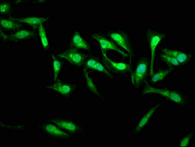 SSH3 Polyclonal Antibody - image 4