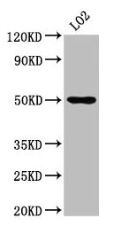 IHC image of CAC15329 diluted at 1:700 and staining in paraffin-embedded human kidney tissue performed on a Leica BondTM system. After dewaxing and hydration, antigen retrieval was mediated by high pressure in a citrate buffer (pH 6.0). Section was blocked with 10% normal goat serum 30min at RT. Then primary antibody (1% BSA) was incubated at 4°C overnight. The primary is detected by a biotinylated secondary antibody and visualized using an HRP conjugated SP system.