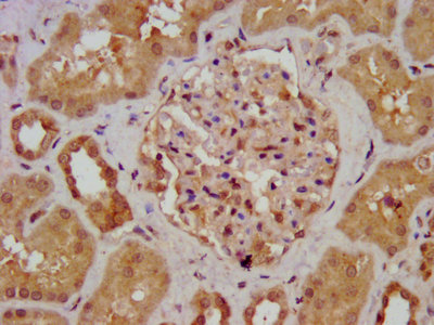IHC image of CAC15329 diluted at 1:700 and staining in paraffin-embedded human liver tissue performed on a Leica BondTM system. After dewaxing and hydration, antigen retrieval was mediated by high pressure in a citrate buffer (pH 6.0). Section was blocked with 10% normal goat serum 30min at RT. Then primary antibody (1% BSA) was incubated at 4°C overnight. The primary is detected by a biotinylated secondary antibody and visualized using an HRP conjugated SP system.