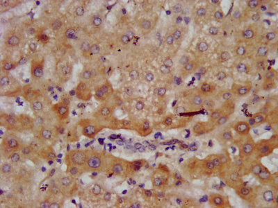 Immunofluorescence staining of HepG2 cells with CAC15329 at 1:233, counter-stained with DAPI. The cells were fixed in 4% formaldehyde, permeabilized using 0.2% Triton X-100 and blocked in 10% normal Goat Serum. The cells were then incubated with the antibody overnight at 4°C. The secondary antibody was Alexa Fluor 488-congugated AffiniPure Goat Anti-Rabbit IgG(H+L).
