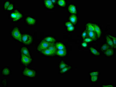 AGXT2 Polyclonal Antibody - image 5