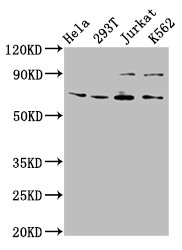 IHC image of CAC15330 diluted at 1:300 and staining in paraffin-embedded human lung tissue performed on a Leica BondTM system. After dewaxing and hydration, antigen retrieval was mediated by high pressure in a citrate buffer (pH 6.0). Section was blocked with 10% normal goat serum 30min at RT. Then primary antibody (1% BSA) was incubated at 4°C overnight. The primary is detected by a biotinylated secondary antibody and visualized using an HRP conjugated SP system.
