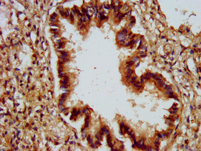 ALG9 Polyclonal Antibody - image 3