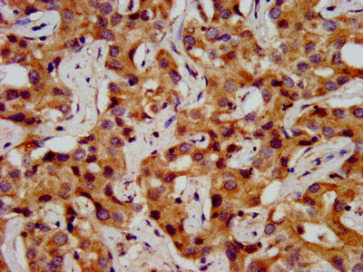 ONECUT1 Polyclonal Antibody - image 3