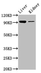 Immunofluorescence staining of HepG2 cells with CAC15334 at 1:100, counter-stained with DAPI. The cells were fixed in 4% formaldehyde, permeabilized using 0.2% Triton X-100 and blocked in 10% normal Goat Serum. The cells were then incubated with the antibody overnight at 4°C. The secondary antibody was Alexa Fluor 488-congugated AffiniPure Goat Anti-Rabbit IgG(H+L).