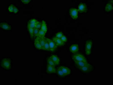 IHC image of CAC15334 diluted at 1:300 and staining in paraffin-embedded human liver tissue performed on a Leica BondTM system. After dewaxing and hydration, antigen retrieval was mediated by high pressure in a citrate buffer (pH 6.0). Section was blocked with 10% normal goat serum 30min at RT. Then primary antibody (1% BSA) was incubated at 4°C overnight. The primary is detected by a biotinylated secondary antibody and visualized using an HRP conjugated SP system.