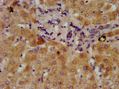 IHC image of CAC15334 diluted at 1:300 and staining in paraffin-embedded human kidney tissue performed on a Leica BondTM system. After dewaxing and hydration, antigen retrieval was mediated by high pressure in a citrate buffer (pH 6.0). Section was blocked with 10% normal goat serum 30min at RT. Then primary antibody (1% BSA) was incubated at 4°C overnight. The primary is detected by a biotinylated secondary antibody and visualized using an HRP conjugated SP system.