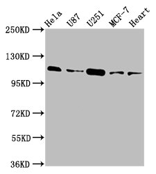 IHC image of CAC15336 diluted at 1:600 and staining in paraffin-embedded human small intestine tissue performed on a Leica BondTM system. After dewaxing and hydration, antigen retrieval was mediated by high pressure in a citrate buffer (pH 6.0). Section was blocked with 10% normal goat serum 30min at RT. Then primary antibody (1% BSA) was incubated at 4°C overnight. The primary is detected by a biotinylated secondary antibody and visualized using an HRP conjugated SP system.