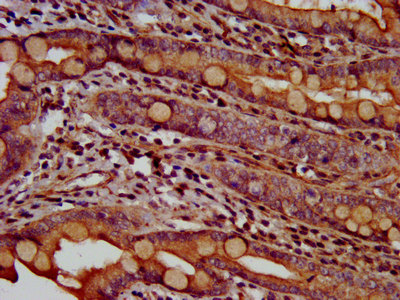 Immunofluorescence staining of HepG2 cells with CAC15336 at 1:200, counter-stained with DAPI. The cells were fixed in 4% formaldehyde, permeabilized using 0.2% Triton X-100 and blocked in 10% normal Goat Serum. The cells were then incubated with the antibody overnight at 4°C. The secondary antibody was Alexa Fluor 488-congugated AffiniPure Goat Anti-Rabbit IgG(H+L).