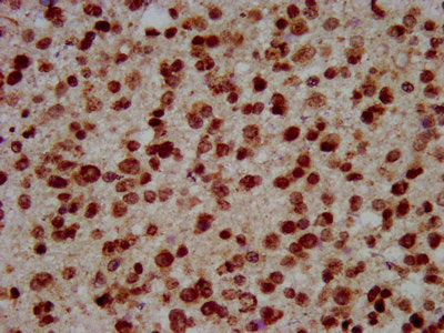 Immunofluorescence staining of Hela cells with CAC15347 at 1:1, counter-stained with DAPI. The cells were fixed in 4% formaldehyde, permeabilized using 0.2% Triton X-100 and blocked in 10% normal Goat Serum. The cells were then incubated with the antibody overnight at 4°C. The secondary antibody was Alexa Fluor 488-congugated AffiniPure Goat Anti-Rabbit IgG(H+L).