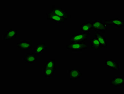 Western Blot, Positive WB detected in: Jurkat whole cell lysate, 293 whole cell lysate, HepG2 whole cell lysate (treated by 30mM sodium butyrate for 4h), All lanes: HIST1H3A antibody at 0.9ug/ml, Secondary, Goat polyclonal to rabbit IgG at 1/50000 dilution, Predicted band size: 16 kDa, Observed band size: 16 kDa