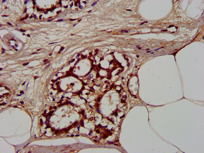 Immunofluorescence staining of HepG2 cells with CAC15354 at 1:100, counter-stained with DAPI. The cells were fixed in 4% formaldehyde, permeabilized using 0.2% Triton X-100 and blocked in 10% normal Goat Serum. The cells were then incubated with the antibody overnight at 4°C. The secondary antibody was Alexa Fluor 488-congugated AffiniPure Goat Anti-Rabbit IgG(H+L).