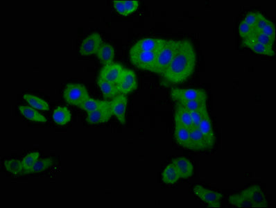 CLCNKB Polyclonal Antibody - image 4
