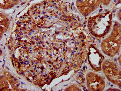 IHC image of CAC15364 diluted at 1:400 and staining in paraffin-embedded human spleen tissue performed on a Leica BondTM system. After dewaxing and hydration, antigen retrieval was mediated by high pressure in a citrate buffer (pH 6.0). Section was blocked with 10% normal goat serum 30min at RT. Then primary antibody (1% BSA) was incubated at 4°C overnight. The primary is detected by a biotinylated secondary antibody and visualized using an HRP conjugated SP system.