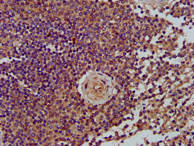 Immunofluorescence staining of HepG2 cells with CAC15364 at 1:133, counter-stained with DAPI. The cells were fixed in 4% formaldehyde, permeabilized using 0.2% Triton X-100 and blocked in 10% normal Goat Serum. The cells were then incubated with the antibody overnight at 4°C. The secondary antibody was Alexa Fluor 488-congugated AffiniPure Goat Anti-Rabbit IgG(H+L).