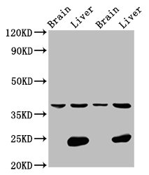 Immunofluorescence staining of A549 cells with CAC15365 at 1:66, counter-stained with DAPI. The cells were fixed in 4% formaldehyde, permeabilized using 0.2% Triton X-100 and blocked in 10% normal Goat Serum. The cells were then incubated with the antibody overnight at 4°C. The secondary antibody was Alexa Fluor 488-congugated AffiniPure Goat Anti-Rabbit IgG(H+L).