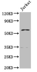 IHC image of CAC15368 diluted at 1:300 and staining in paraffin-embedded human pancreatic cancer performed on a Leica BondTM system. After dewaxing and hydration, antigen retrieval was mediated by high pressure in a citrate buffer (pH 6.0). Section was blocked with 10% normal goat serum 30min at RT. Then primary antibody (1% BSA) was incubated at 4°C overnight. The primary is detected by a biotinylated secondary antibody and visualized using an HRP conjugated SP system.