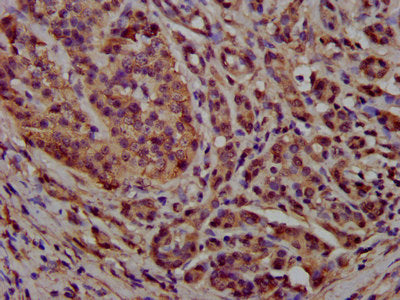 IHC image of CAC15368 diluted at 1:300 and staining in paraffin-embedded human kidney tissue performed on a Leica BondTM system. After dewaxing and hydration, antigen retrieval was mediated by high pressure in a citrate buffer (pH 6.0). Section was blocked with 10% normal goat serum 30min at RT. Then primary antibody (1% BSA) was incubated at 4°C overnight. The primary is detected by a biotinylated secondary antibody and visualized using an HRP conjugated SP system.