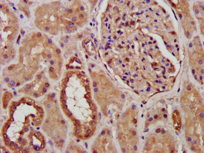 PCCB Polyclonal Antibody - image 4