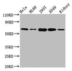 IHC image of CAC15372 diluted at 1:200 and staining in paraffin-embedded human lymph node tissue performed on a Leica BondTM system. After dewaxing and hydration, antigen retrieval was mediated by high pressure in a citrate buffer (pH 6.0). Section was blocked with 10% normal goat serum 30min at RT. Then primary antibody (1% BSA) was incubated at 4°C overnight. The primary is detected by a biotinylated secondary antibody and visualized using an HRP conjugated SP system.