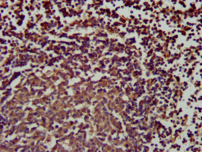 Immunofluorescence staining of HepG2 cells with CAC15372 at 1:66, counter-stained with DAPI. The cells were fixed in 4% formaldehyde, permeabilized using 0.2% Triton X-100 and blocked in 10% normal Goat Serum. The cells were then incubated with the antibody overnight at 4°C. The secondary antibody was Alexa Fluor 488-congugated AffiniPure Goat Anti-Rabbit IgG(H+L).
