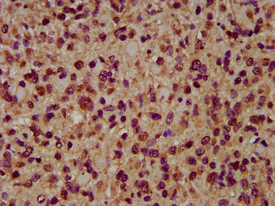 IHC image of CAC15378 diluted at 1:200 and staining in paraffin-embedded human brain tissue performed on a Leica BondTM system. After dewaxing and hydration, antigen retrieval was mediated by high pressure in a citrate buffer (pH 6.0). Section was blocked with 10% normal goat serum 30min at RT. Then primary antibody (1% BSA) was incubated at 4°C overnight. The primary is detected by a biotinylated secondary antibody and visualized using an HRP conjugated SP system.