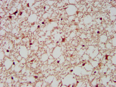 Immunofluorescence staining of Hela cells with CAC15378 at 1:66, counter-stained with DAPI. The cells were fixed in 4% formaldehyde, permeabilized using 0.2% Triton X-100 and blocked in 10% normal Goat Serum. The cells were then incubated with the antibody overnight at 4°C. The secondary antibody was Alexa Fluor 488-congugated AffiniPure Goat Anti-Rabbit IgG(H+L).