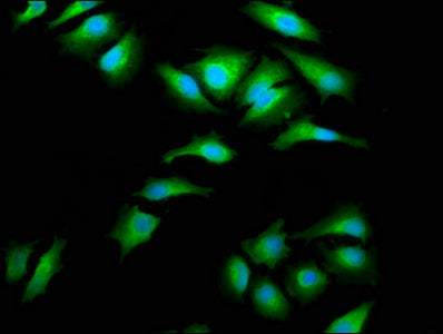 AIMP1 Polyclonal Antibody - image 5