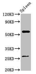 ACD Polyclonal Antibody - image 2
