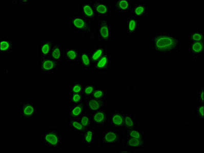 Chromatin Immunoprecipitation Hela (4*10 6 , treated with 30mM sodium butyrate for 4h) were treated with Micrococcal Nuclease, sonicated, and immunoprecipitated with 5ug anti-HIST1H3A (CAC15412) or a control normal rabbit IgG. The resulting ChIP DNA was quantified using real-time PCR with primers against the β-Globin promoter.