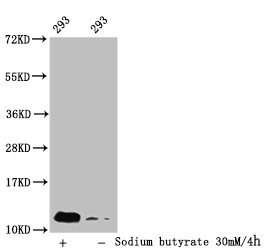 Immunofluorescence staining of Hela cells (treated with 30mM sodium butyrate for 4h) with CAC15413 at 1:25, counter-stained with DAPI. The cells were fixed in 4% formaldehyde, permeabilized using 0.2% Triton X-100 and blocked in 10% normal Goat Serum. The cells were then incubated with the antibody overnight at 4°C. The secondary antibody was Alexa Fluor 488-congugated AffiniPure Goat Anti-Rabbit IgG(H+L).