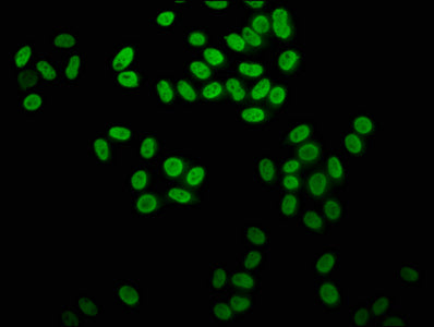 2-hydroxyisobutyryl-HIST1H4A (K31) Polyclonal Antibody - image 3