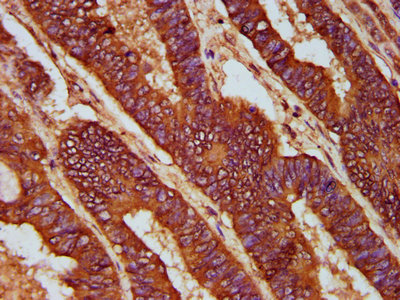 Immunofluorescence staining of HepG2 cells with CAC15422 at 1:66, counter-stained with DAPI. The cells were fixed in 4% formaldehyde, permeabilized using 0.2% Triton X-100 and blocked in 10% normal Goat Serum. The cells were then incubated with the antibody overnight at 4°C. The secondary antibody was Alexa Fluor 488-congugated AffiniPure Goat Anti-Rabbit IgG(H+L).